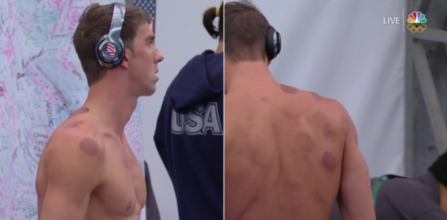 phelps-banki-1